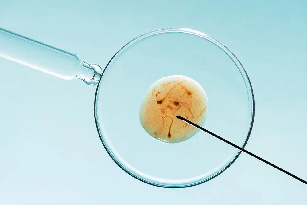 does alcohol affect spermConsuming alcohol linked to lower sperm concentration