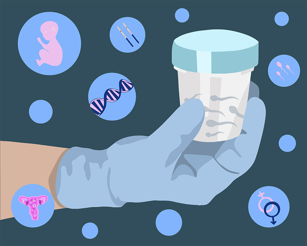 freezing sperm before vasectomy, fertility preservation