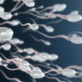 what happens to sperm after vasectomy sperm after vasectomy vasectomy procedure vasectomy and sperm sperm production after vasectomy