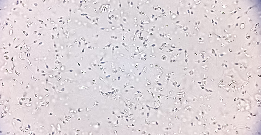 does vitamin c increase testosterone, vitamin c sperm quality, sperm motility, sperm dna protection